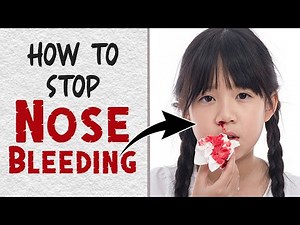 How to Stop a Nosebleed in Less Than 5 Minutes || Home Remedies for Nose bleeding