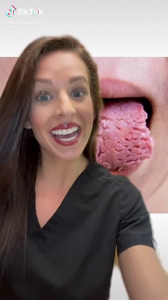 Understanding Fissured Tongue: Causes and Treatment Options