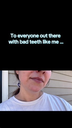 #fyp #viral #badteeth | bad teeth girl