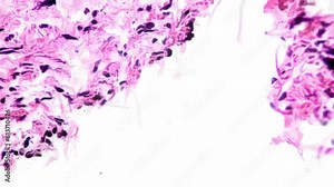 Sample of artery of human being in longitudinal section under microscope 400x on bright field. Macro footage of blood vessel made in laboratory to know its structure. Scientific research in anatomy