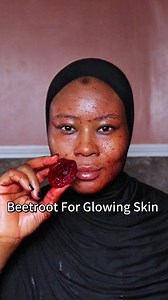 The secret’s out! 😎 For those of you who guessed beetroot on my face, you were RIGHT! Take your flowers 💐🌿 This little DIY beetroot mask is all-natural, simple, and fun to try (but remember: patch test first ) Would you try this at home? #beetroot #diyskincare #glowingskin #naturalskincare #honey #skincare #homeremedies #NaturalBeauty #ClearSkin #skinbrightening #beauty | Zainab Iye - Beauty Content Creator