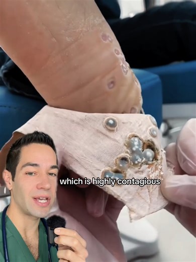 Why You Should Wear Flip Flops in Public Pools