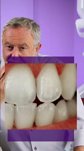 Three shades of natural tooth color