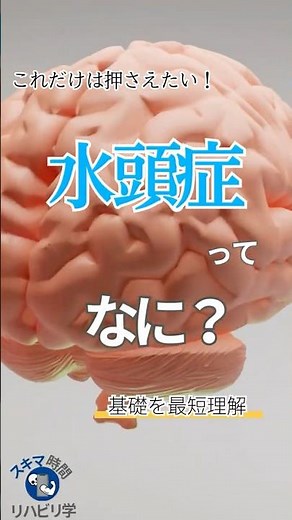 【基礎】水頭症ってなに？PTなら知っておきたい基礎 #理学療法士国家試験 #理学療法士 #作業療法士国家試験 #作業療法士 #基礎 #脳 #髄液循環 #脳脊髄液 #水頭症 #病態