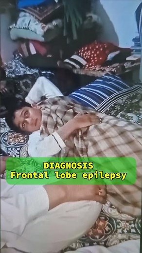 Frontal Lobe Seizures | Autosomal Dominant Nocturnal Frontal Lobe Epilepsy (ADNFLE) | Patient video