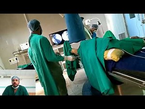 Proximal Femoral Nailing (PFN)