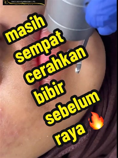 Laser⚡️Light ™ Medical (@thelaserandlight.com)’s videos with original sound - Laser⚡️Light ™ Medical