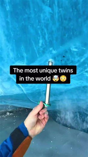 The most unique twins in the world 😳🤯#fyp #reality #viralvideos #viral #explorer