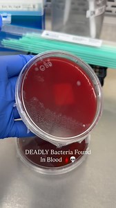 Little wine bottle, I mean, Blood culture POPPED POSITIVE… Gram-positive rods? Turns out: Listeria monocytogenes 🧫🧪 This facultative intracellular pathogen can cause invasive disease, especially in: 👶 Neonates 🤰 Pregnant patients 🧓 Elderly 🧬 Immunocompromised individuals Don’t sleep on Listeria — it crosses the blood-brain and placental barriers, and sepsis or meningitis can follow. Listeria outbreaks are often linked to contaminated dairy, deli meats, and ready-to-eat foods — it thrives i