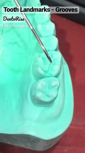 Landmarks on tooth surfaces | GROOVES PART 2 MAXILLARY FIRST MOLAR | LINK IN DESCRIPTION Shortvideo
