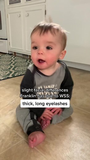 Understanding Wiedemann-Steiner Syndrome in Franklin: A Detailed Look