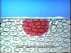 1985 Cortizone 5 Itch Cream Commercial