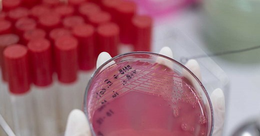 Polynucléaires basophiles : bas ou élevés, rôle, interprétation des analyses