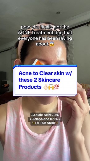 Discover the game-changing ACNE Treatment duo for clear, beautiful skin