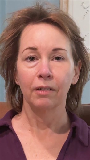 Real Results. Really Fast. Plexaderm Rapid Reduction Serum is a fast-acting formula that visibly smooths the appearance of puffiness, wrinkles, and crow’s feet — in just minutes. No needles. No appointments. Just results you can see and feel. ✨ Apply once a day ✨ Works in minutes ✨ Clinically tested and trusted by thousands Experience a smoother, more refreshed look — right from home. Tap below to see the difference Plexaderm can make. | Plexaderm Skincare