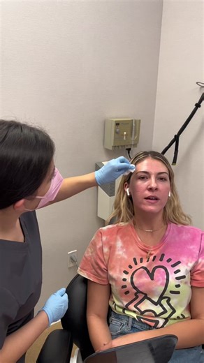 The fractionated erbium laser is a form of laser resurfacing that stimulates new collagen and elastin production for skin remodeling. With minimal downtime, the laser targets acne scars, brown spots, fine lines, and can be done to improve overall skin texture and glow. Stayed tuned for a part two of our patient’s results! #erbium #erbiumresurfacing #erbiumlaser #dermatologist #dermatology #beverlyhills #rodeodrive