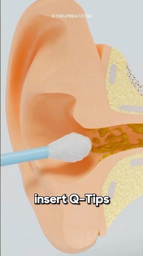 Why Using Q-Tips Feels So Good 🥴 (not good)