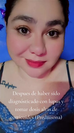 Videos de vlog viviendo con Lupus y más. (@vlogsviviendoconlupus5) con “sonido original - vlog viviendo con Lupus y más.”