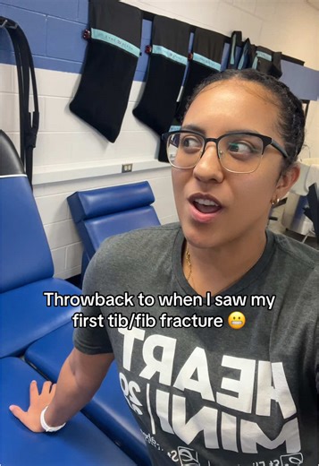 Understanding Lower Leg Fractures in Athletes