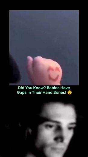 The Mind-Blowing Truth About Baby Bones 🩻#shorts #ytshorts #xray #explore #science #physics