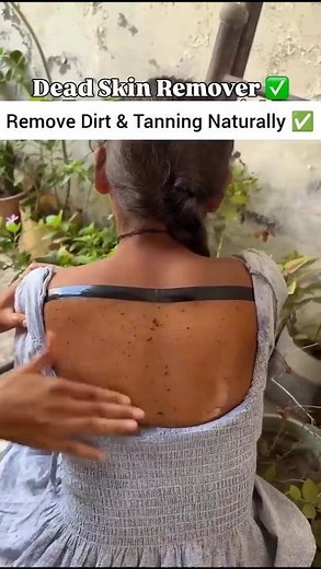✅Dark neck cleaning tips | Remover Dark & Suntan |#haircare #dark