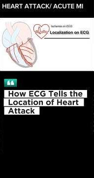 MYOCARDIAL INFRACTION: MI Investigations Made Easy | ECG, Troponin & Echo Explained MI SERIES PART2