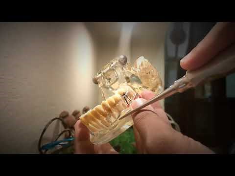 How to Extract a Root tip or Tooth using Straight Elevator by Dr. Varun Pandula