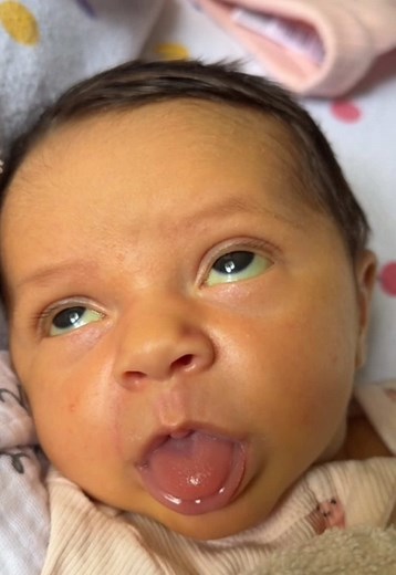 Incase you didn’t know, this is completely normal, babies are just a lil weird. She is 9 months old and thriving !! The jaundice was taken care of 🫶🏼