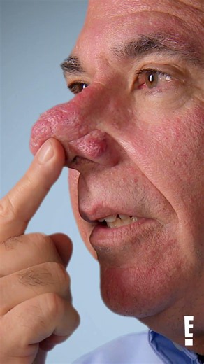 Andy's nose grew an inch over a single year?! #botched