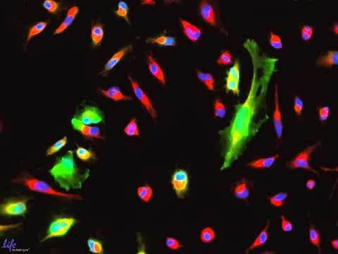 Time Lapse Imaging of HeLa Cells Treated With Latrunculin A