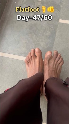 Flatfoot best exercise 🦶🫵✅#physical #runner #exercise