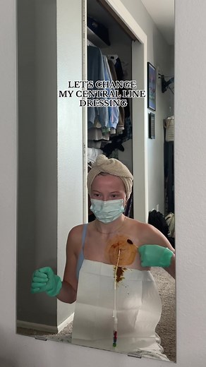 Shower Dressing Change for Central Line and Broviac | Chronic Illness Care
