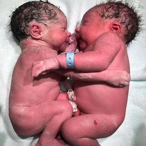 2.5M views · 283K reactions | New born babies are so sweet a cuddle and i just love them | 홲횑횞횋횋횢 | Facebook