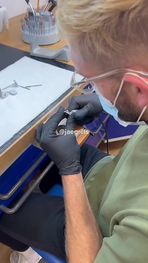 Custom Gold Grills for Men and Women | JaeGrills