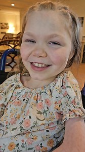 68K views · 4.1K reactions | Ana started the annual process of #serialcasting yesterday so she can get new braces (AFOs and KAFOs) to get her through the next year. Here's some more information about SERIAL CASTING for you! #arthrogryposismultiplexcongenita #amcstory #orthotics #amcstrong #arthrogryposistreatment | Team AMC Ana | Facebook