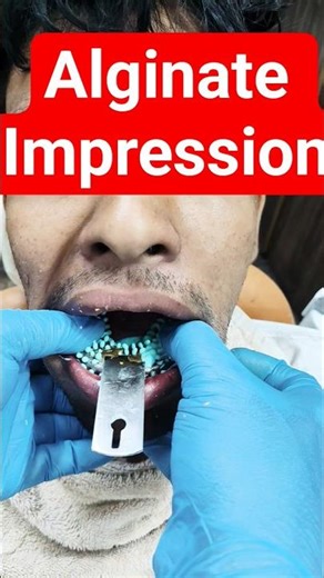 #Alginate Impression #dental impression #Lower Impression with Alginate impression material