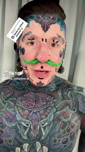 Understanding Laser Tattoo Removal Process