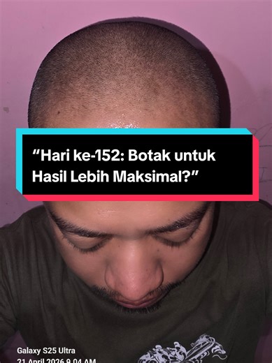 Hari ke-152 penggunaan rutin Minoxidil   Finasteride 0,1% topikal dan dermaroller 2x seminggu. Masuk hari ke-2 setelah rambut dipangkas habis, terlihat distribusi titik-titik rambut baru lebih merata di area frontal hingga mid-scalp. Kulit kepala tampak lebih bersih dari residu, sehingga penyerapan topikal lebih optimal. Pemangkasan rambut hingga sangat pendek bertujuan: Mempermudah pembersihan kerak residu minoxidil Membantu penetrasi serum lebih maksimal ke folikel Memudahkan dermaroller menja