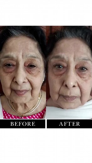 Lifting Face Yoga Facials for Mature Skin 70 & Much More! Indulge in our Holistic Services | Zivafaceyoga