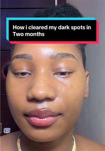 How to Clear Dark Spots in 2 Months | Skincare Routine