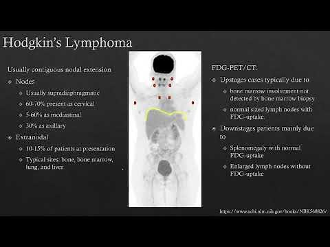 PET CT imaging lymphoma