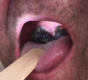 You should go to the hospital immediately if you experience this symptom. | Creative Cooking