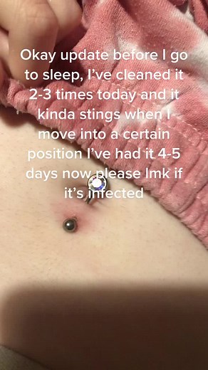 Navel Piercing Healing Process Update | Is It Infected?