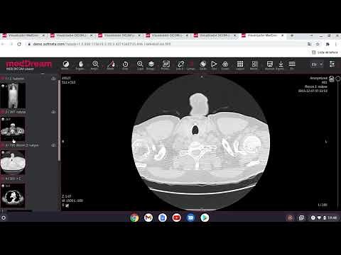 Simulador de radiologia gratuito - MedDream