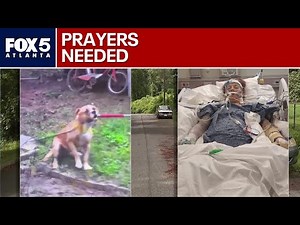 Woman critically injured in vicious dog attack | FOX 5 News