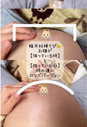 妊婦のお腹の張りを理解しよう