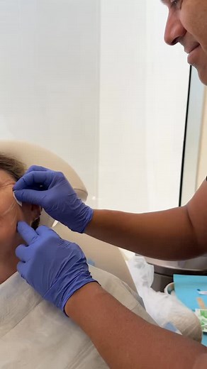 Think PDO Threads are just for wrinkles? Then maybe a defined jawline and tighter skin aren’t for you. Some people don’t mind a little sag, soft edges, or avoiding the camera. But if you’re someone who notices the details— Who prefers clean lines, natural lift, and effortless confidence… PDO Threads might be exactly what you’ve been overlooking. Ready to see the difference? Book your complimentary consultation today — subtle changes make a bold statement. #PDOThreads #JawlineDefined #ThreadLift 