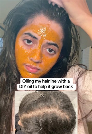 Turmeric Face Mask and DIY Hair Oil for Growth