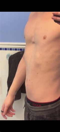 Mans visible heartbeat from Reddit