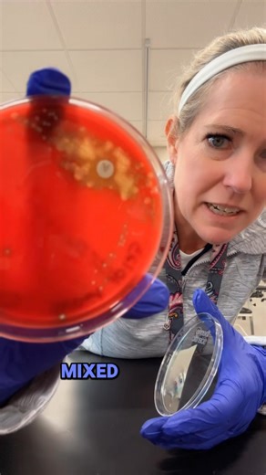 Ever wonder what the “back up” test is to your negative strep looks like? Here you go!!! #Medicallaboratoryscience #strep | Becky Hanson Smith